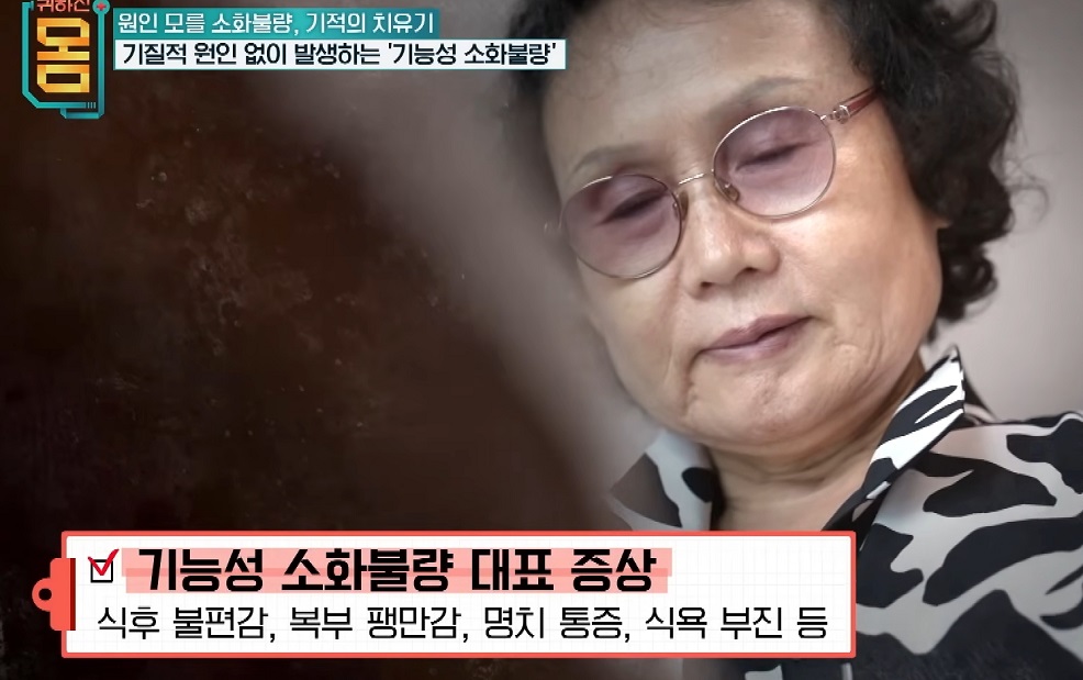 식도-명의-김용희-교수