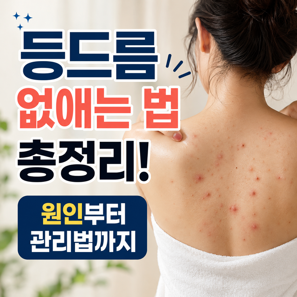 등드름 없애는 법