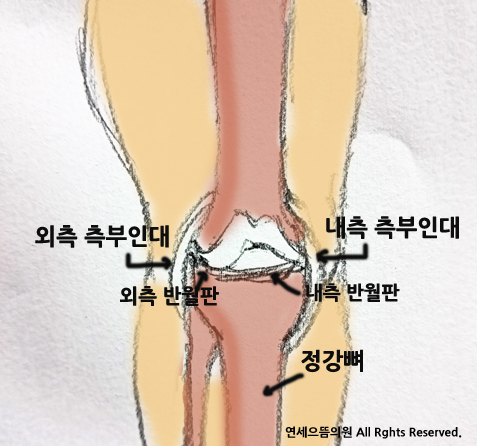무릎통증