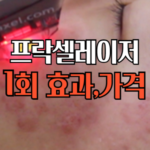 프락셀레이저 1회 가격 및 효과