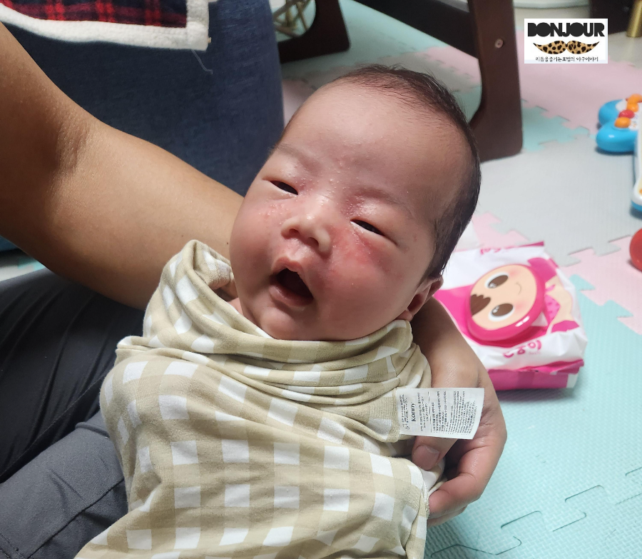 신생아 얼굴에 태열이 나잇는 모습. 얼굴에 울긋불긋한 모습