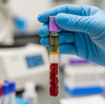 콜레스테롤 정상수치 완벽 정리14