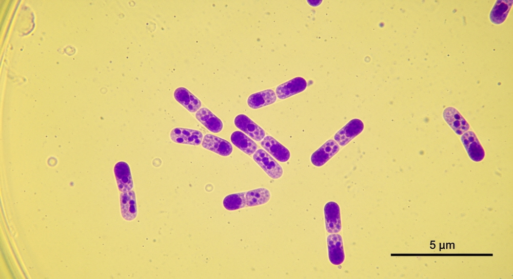 다이어트 유산균 BNR17