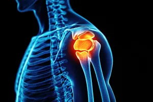 회전근개파열-수술비용