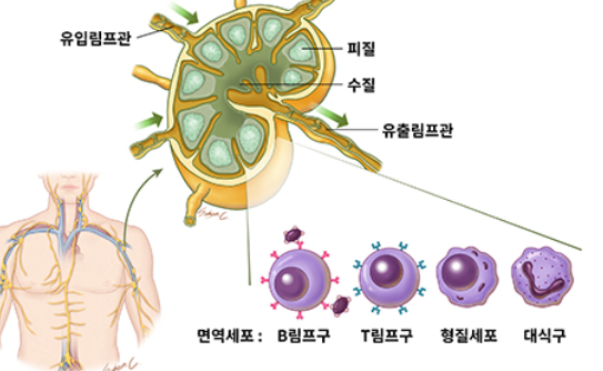 림프절과 암 전이