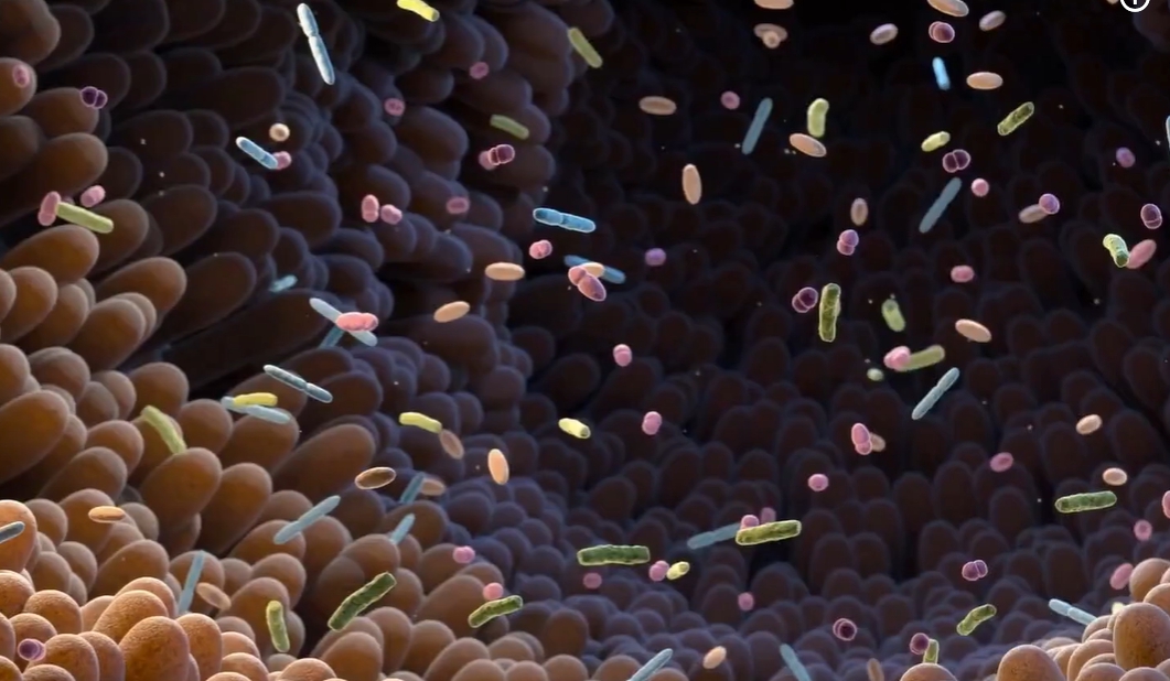 장누수증후군 증상