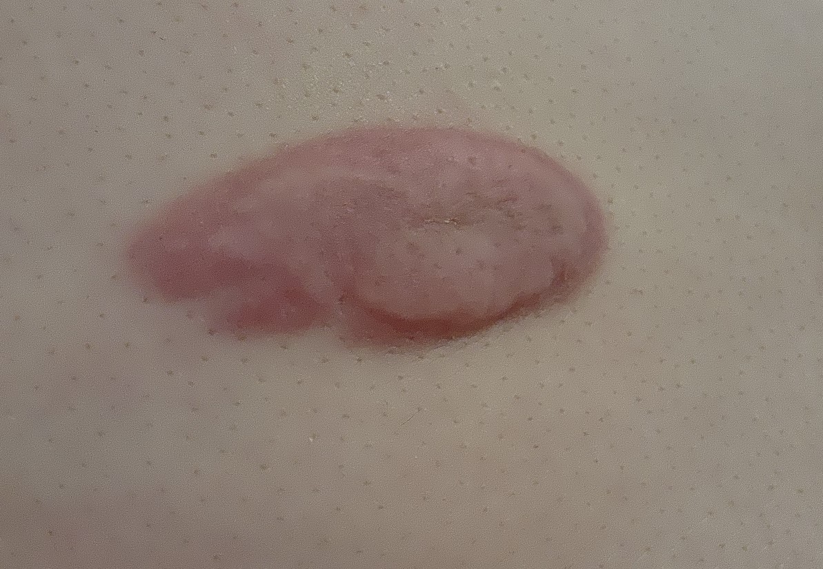 1. 켈리이드 란?