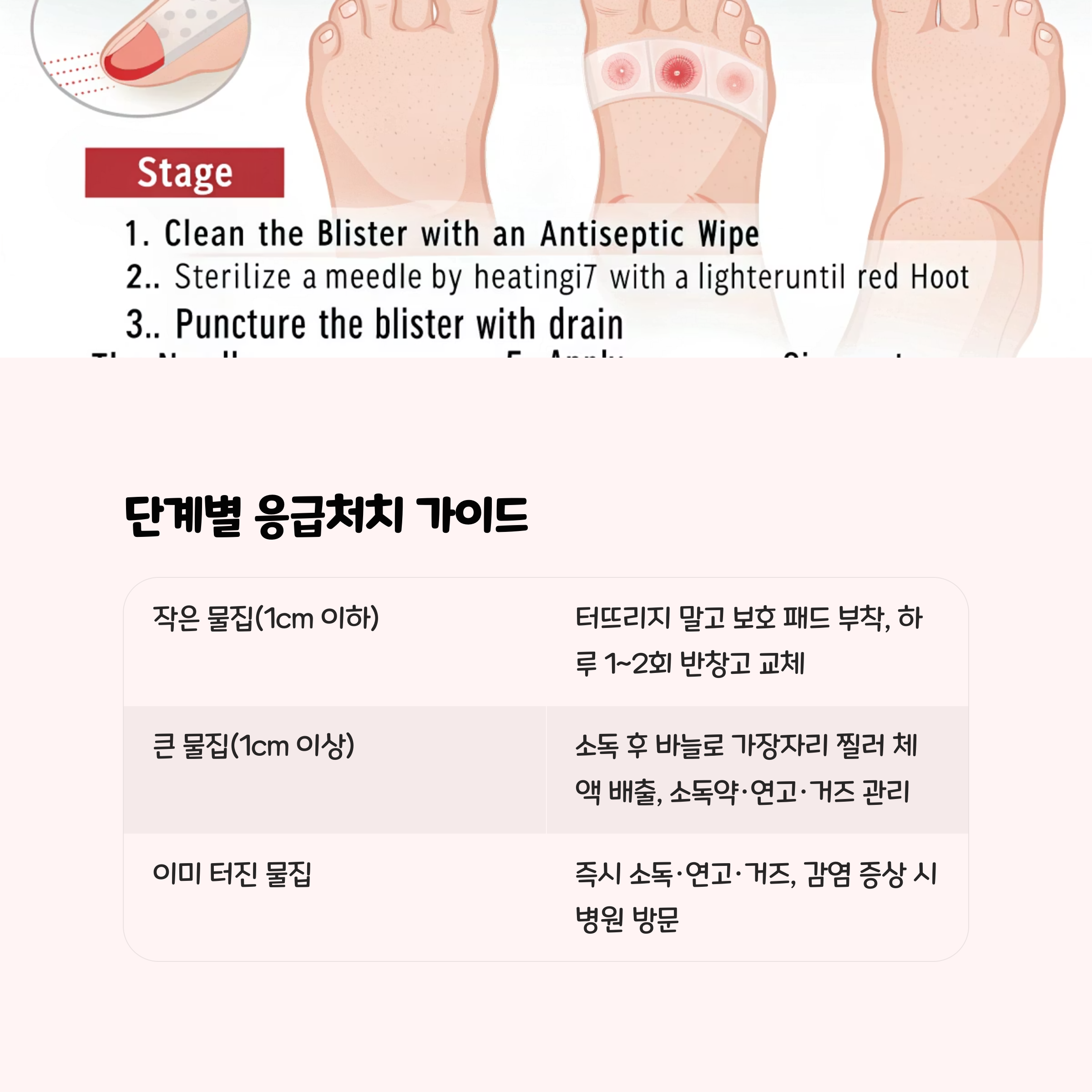 단계별 응급처치