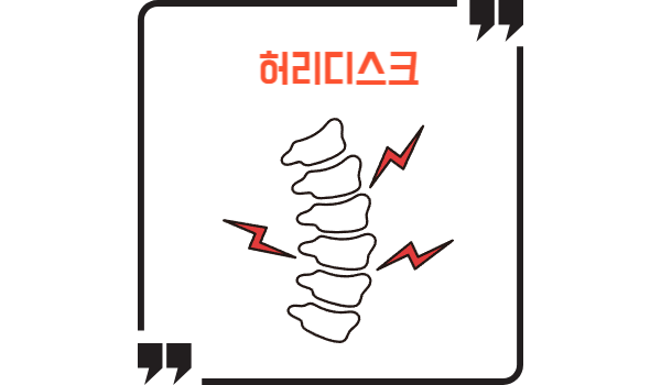허리디스크 모습