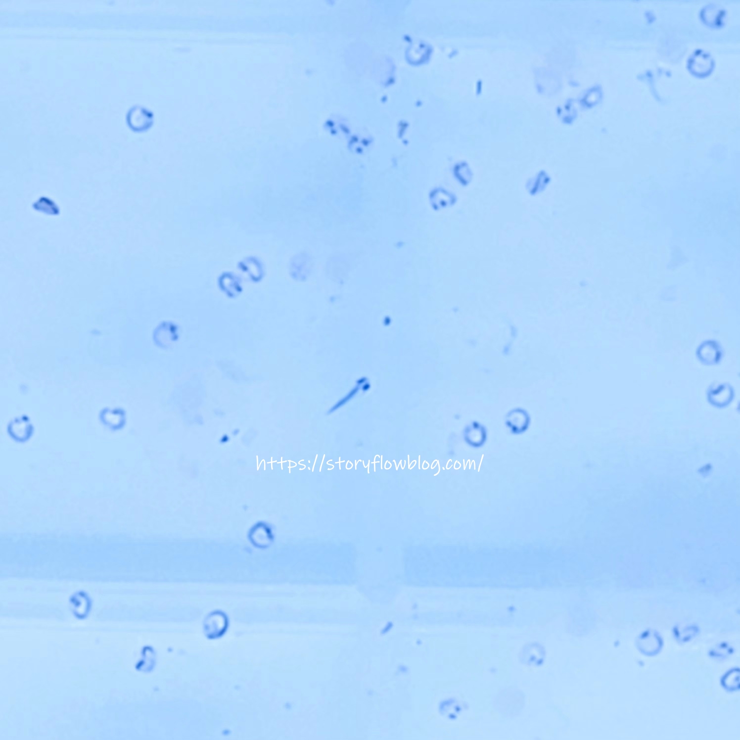 금붕어치어, 치어, 금붕어알