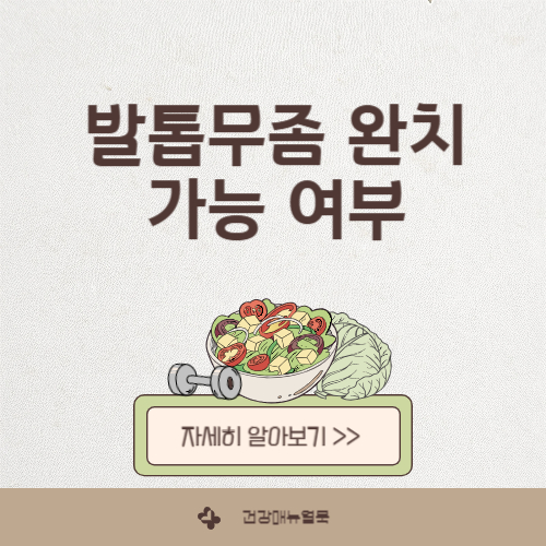 발톱무좀, 약으로 완치 가능