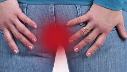 치질-증상-자가치료법-건강