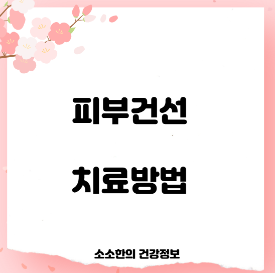 피부건선 치료방법