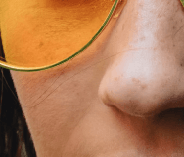 블랙헤드 없애는 방법 - 압출