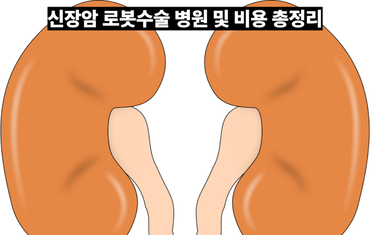 신장암 로봇수술 병원 및 비용 총정리