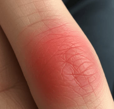 손가락 마디 통증 치료 방법10