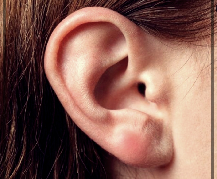 귀 몽우리 생기는 원인 및 해결방법