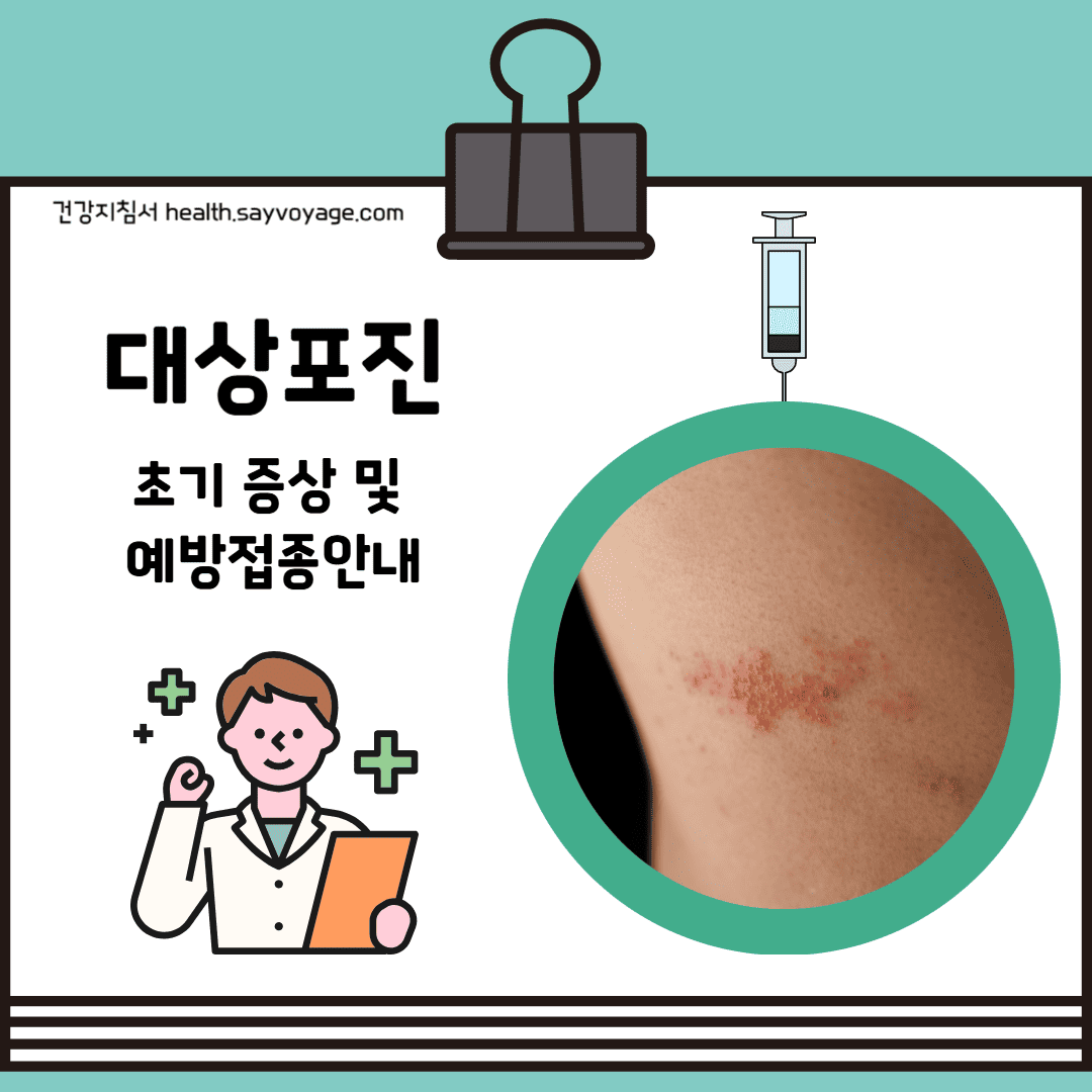 대상포진 알아보기
