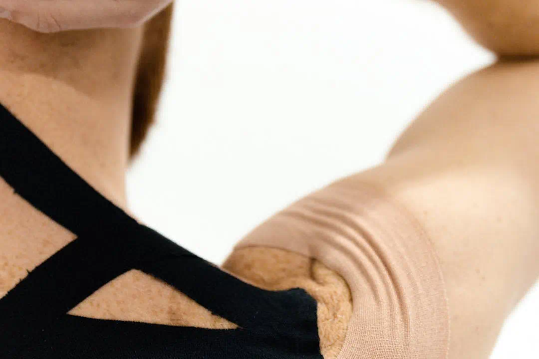 관절염 관련사진4