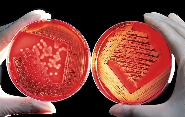 A군 연쇄상구균 Streptococcus pyogenes