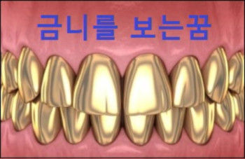 금니를 보는꿈