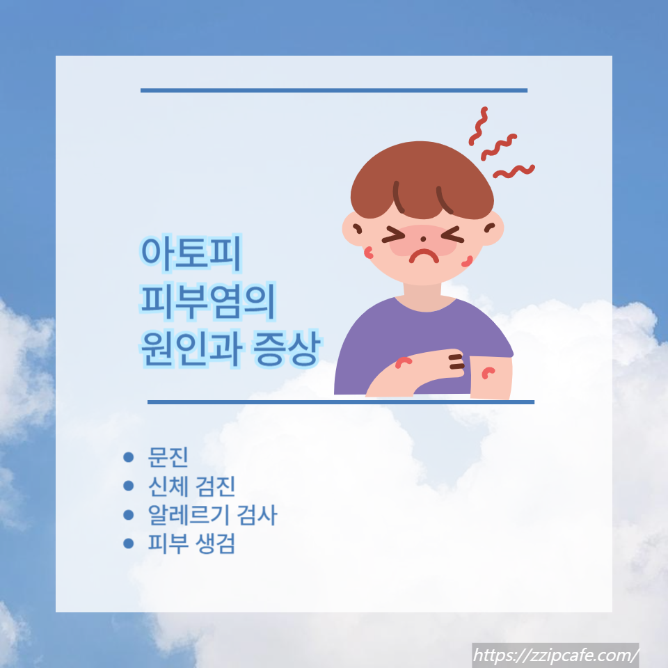 아토피 피부염
