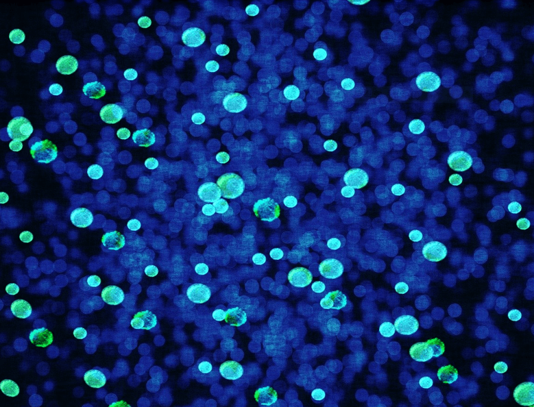 국가건강검진 전년도 미수검자 추가신청방법