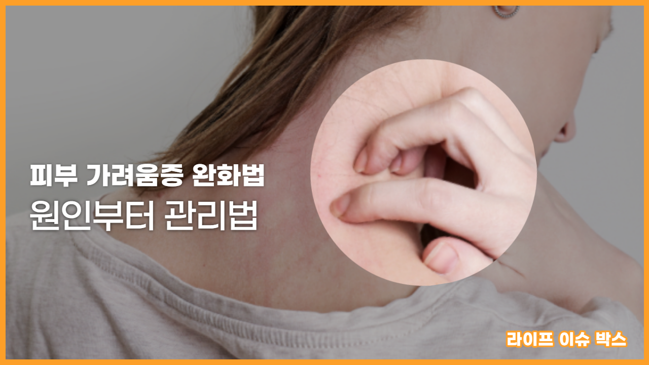 피부 가려움증 완화법