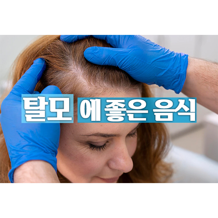 탈모예방에 좋은 음식