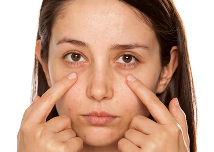 다크서클에좋은음식 추천