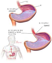 역류성 식도염 야간 증상&amp;#44; 밤에 누우면 더 아픈 이유