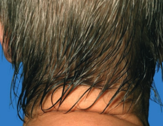 머리에서 땀이 많이 나는 이유