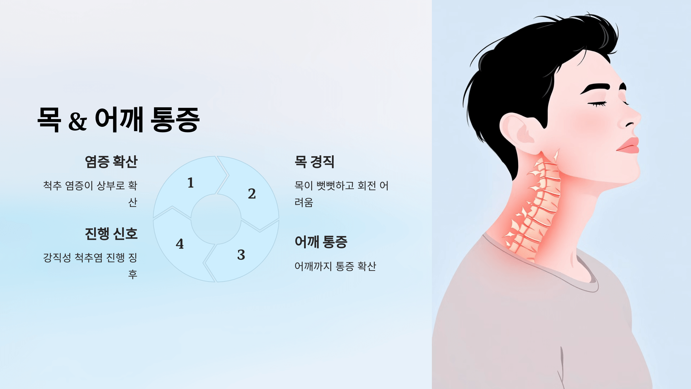 강직성 척추염과 관련된 사진입니다.