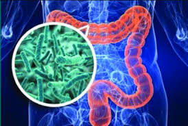 비에날씬프로다이어트유산균 다이어트효능