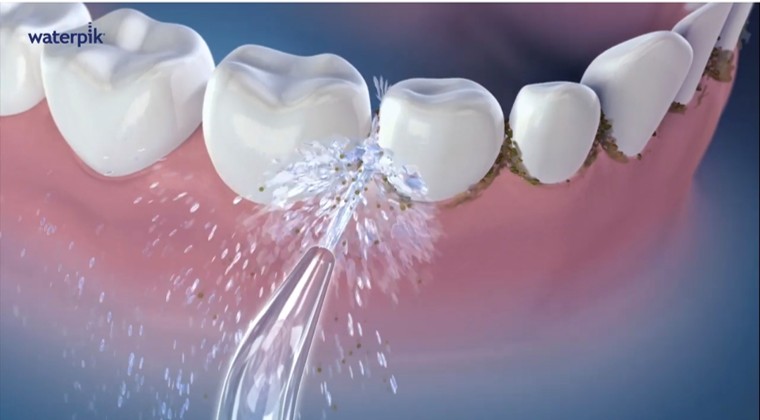 워터픽 WP-670 물탱크 내부 모습 9