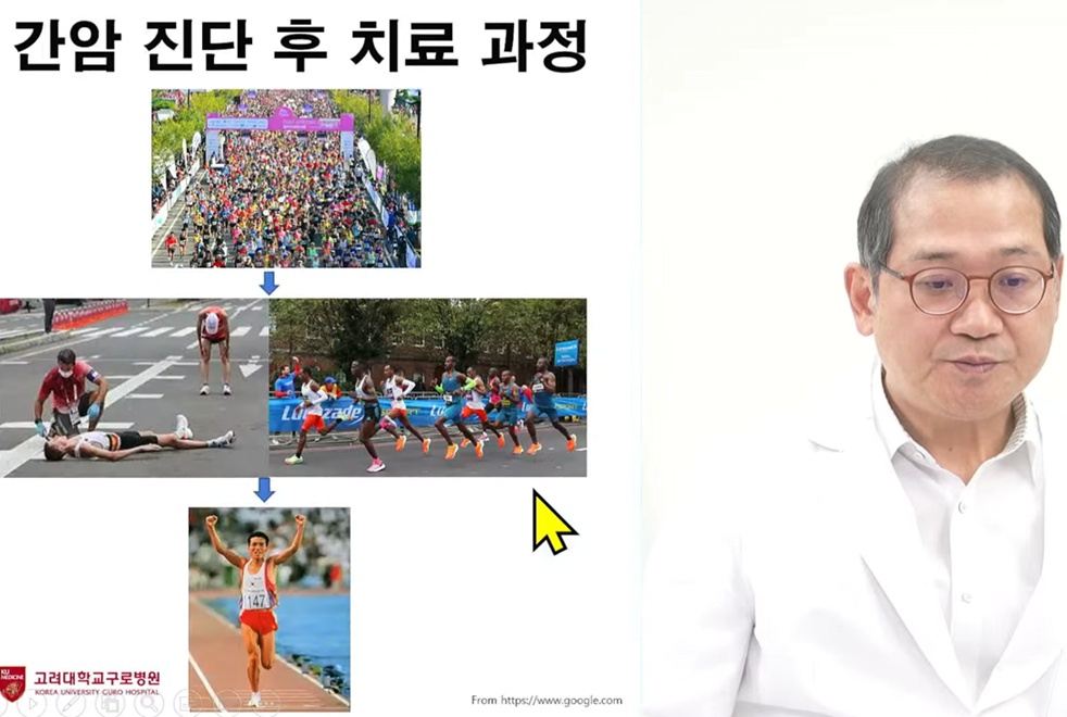간암-치료과정