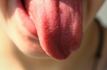 혀가 보내는 이상 신호? 혀질환이 보내는 몸속 이상 신호