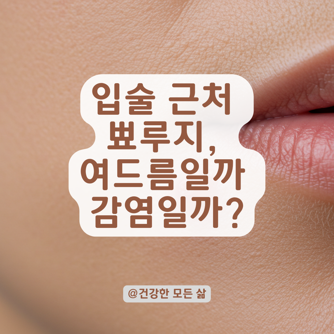 입술 근처에 만성적으로 생기는 뾰루지, 병원 진료 전 알아둘 핵심 포인트.