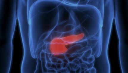 췌장암 초기증상 검사방법 발생원인 총정리(최신)