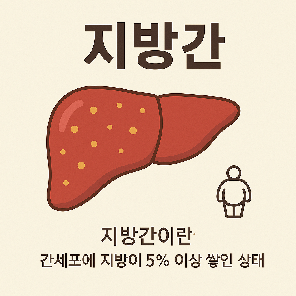지방간 증상과 치료법 썸네일