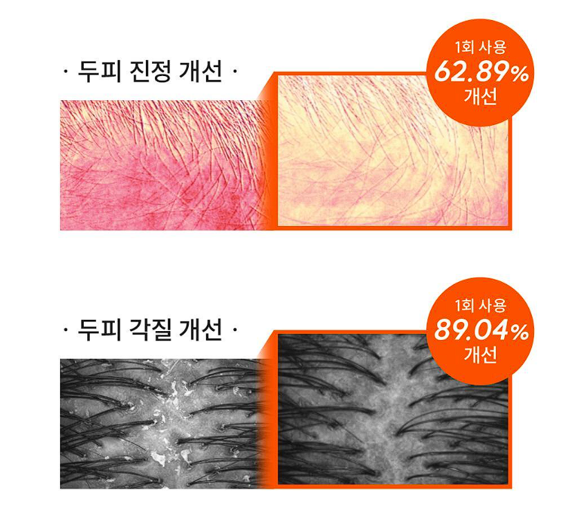 그로우턴 앰플 내돈내산 후기 