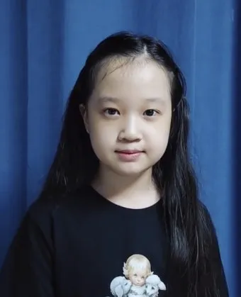이마가 넓은 여자 관상 특징과 해석_5