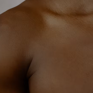 아토피 피부염 진단 기준 치료법 합병증