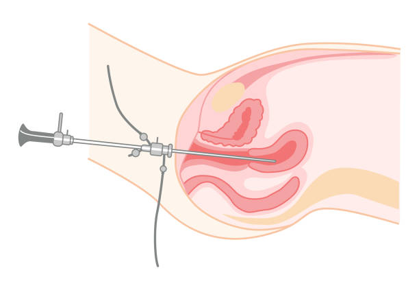 자궁경부확대경 검사 질확대경 확대경 자궁 경부 질 자궁경부암 조직검사 부인과 산부인과 정기검진 HPV Pap smear 여성 건강 자궁경부확대촬영 염증 비용 이상 아세트산 비정상 전암성 병변 비정형 초산 이상 소견 정확도 후 출혈 검사 방법 통증 주의사항