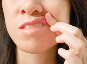 칸디다증 칸디다 감염 칸디다 치료 칸디다 증상 부위별 키워드 구강 칸디다증 (아구창) 질 칸디다증 피부 칸디다 식도 칸디다 칸디다 골관절염 칸디다 복막염 간비장 칸디다증 원인 및 치료 관련 키워드 칸디다증 원인 칸디다 감염 원인 칸디다증 치료법 칸디다 연고 칸디다 항진균제 칸디다증 면역력 강화 예방 및 생활습관 키워드 칸디다증 예방 칸디다에 좋은 음식 칸디다에 좋은 습관 항생제 부작용 칸디다 음식 관련 키워드 칸디다증에 좋은 음식 칸디다 억제 식품 마늘 칸디다 억제 칸디다 녹황색 채소 오메가3 칸디다 기타 연관 키워드 칸디다 전염성 칸디다증 생활 습관 칸디다증 자가진단 칸디다 곰팡이 감염 칸디다증 면역력