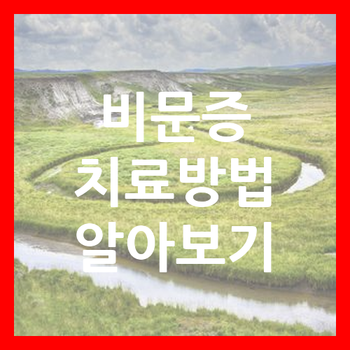 비문증 치료방법 알아보기