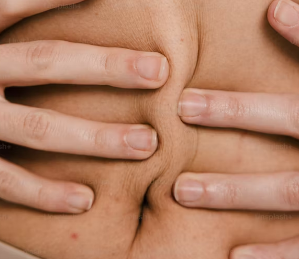 과민성 대장 증후군 증상