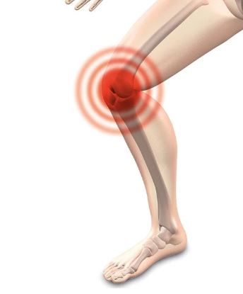 무릎 인공 관절 수술 비용 지원 사업