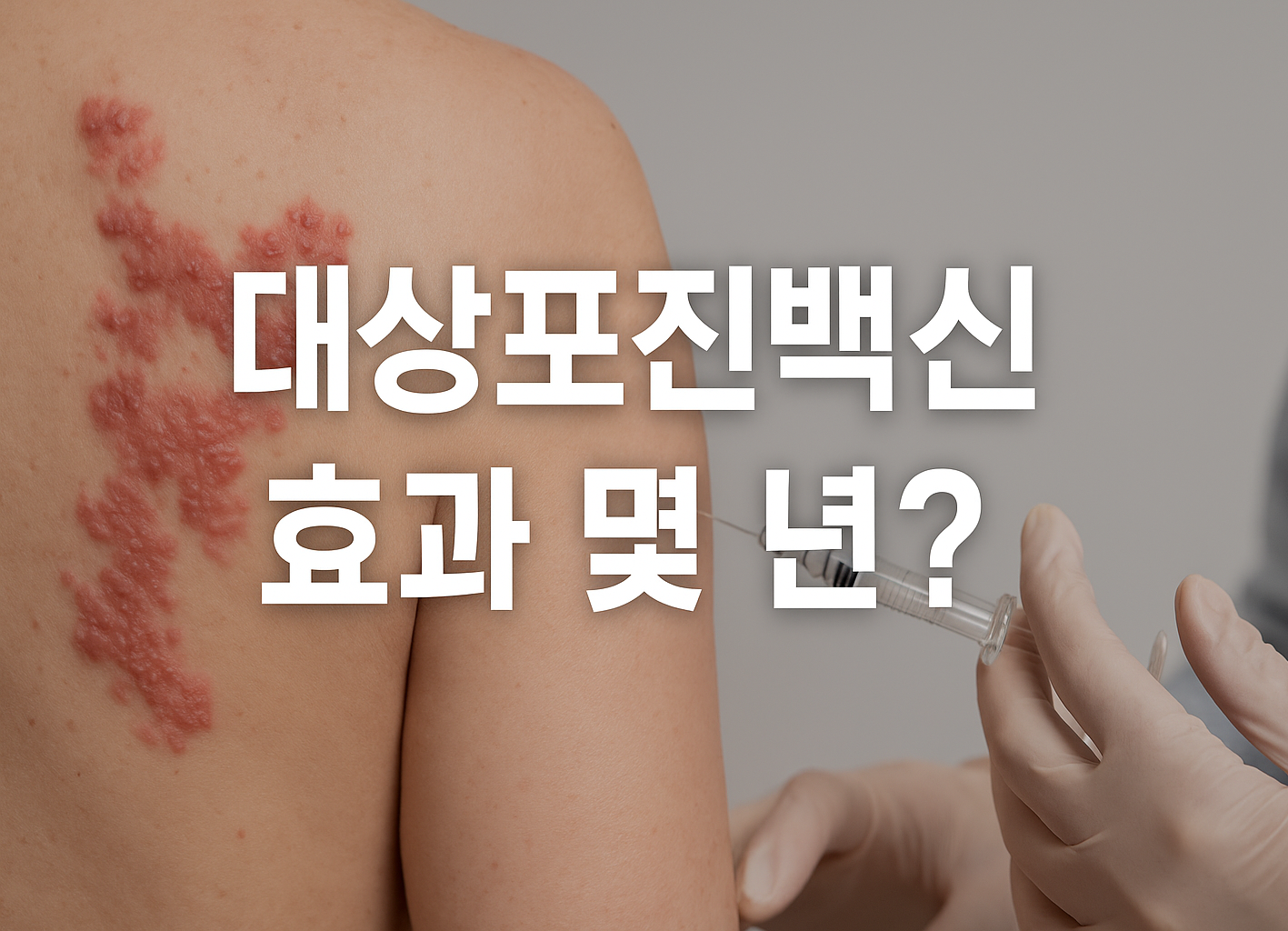 대상포진백신 효과 지속기간 안내
