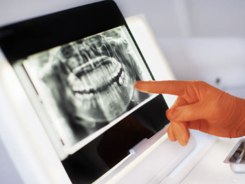 임플란트 시술기간